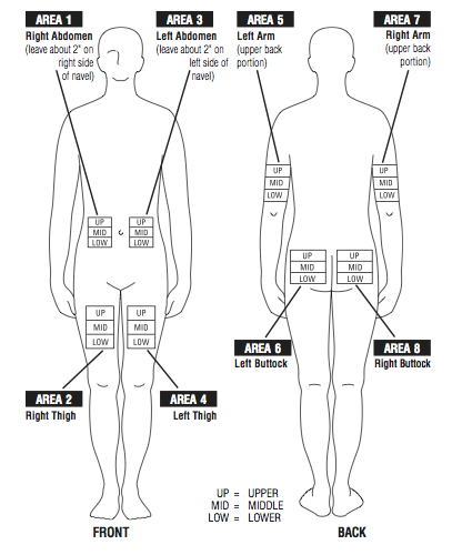 injection sites